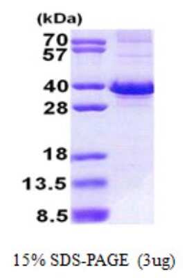 SDS-PAGE: Recombinant Human FBXO6 His Protein [NBP2-23042]