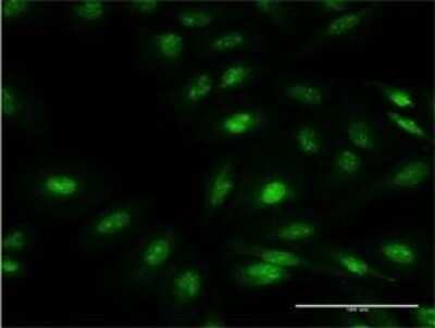 Immunocytochemistry/ Immunofluorescence: FBXO7 Antibody (4G8) [H00025793-M01]