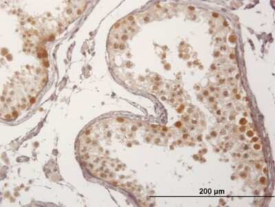 Immunohistochemistry-Paraffin: FBXO7 Antibody [H00025793-B01P]
