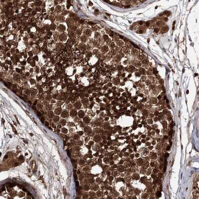 Immunohistochemistry-Paraffin: FBXO7 Antibody [NBP1-84713]