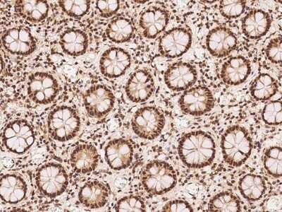 Immunohistochemistry-Paraffin: FBXO7 Antibody [NBP2-97739]