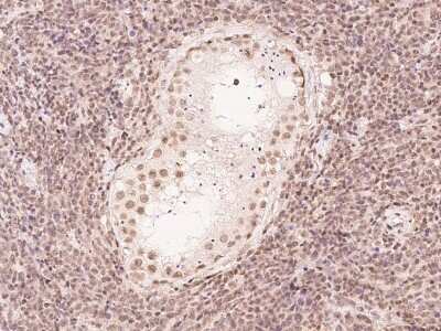 Immunohistochemistry-Paraffin: FBXO7 Antibody [NBP2-97739]