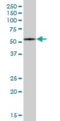 Western Blot: FBXO7 Antibody [H00025793-B01P]