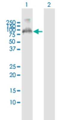 Western Blot: FBXO7 Antibody [H00025793-B01P]