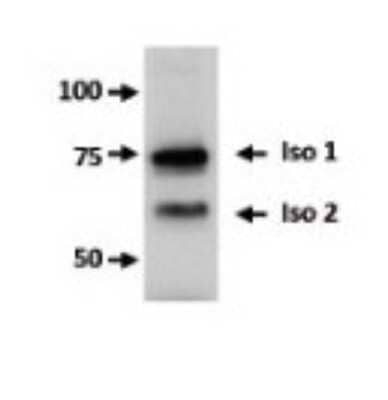 Western Blot: FBXO7 Antibody [NBP1-55051]