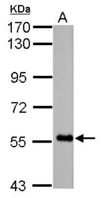 Western Blot: FBXO7 Antibody [NBP2-16452]