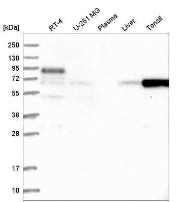 Western Blot: FBXO7 Antibody [NBP2-58563]