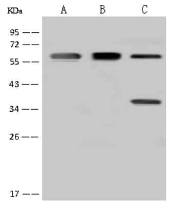 Western Blot: FBXO7 Antibody [NBP2-97739]