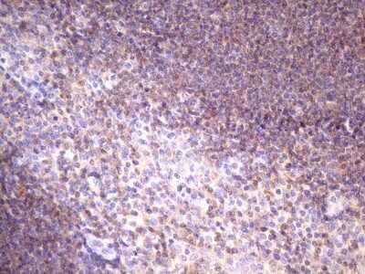 Immunohistochemistry: FBXO8 Antibody (OTI3C5) [NBP2-45622]