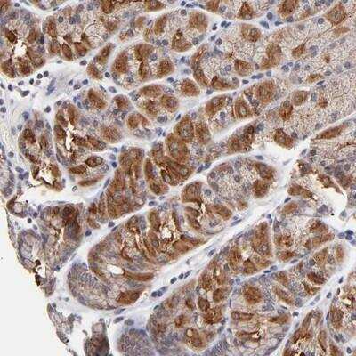 Immunohistochemistry-Paraffin: FBXO8 Antibody [NBP1-84716]
