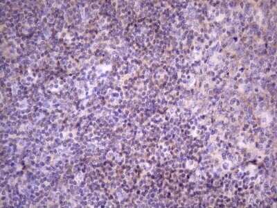 Immunohistochemistry: FBXO8 Antibody (OTI3C5) - Azide and BSA Free [NBP2-71794]