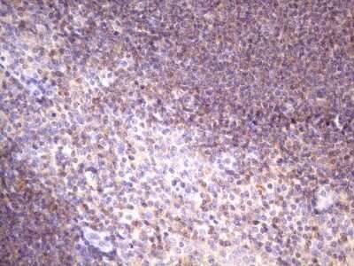 Immunohistochemistry: FBXO8 Antibody (OTI3C5) - Azide and BSA Free [NBP2-71794]