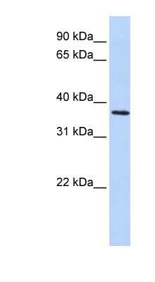 Western Blot: FBXO8 Antibody [NBP1-55317]