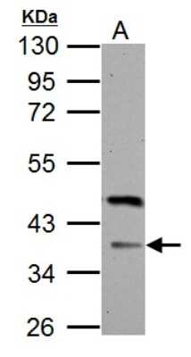 Western Blot: FBXO8 Antibody [NBP2-16453]