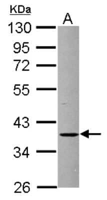 Western Blot: FBXO8 Antibody [NBP2-16453]