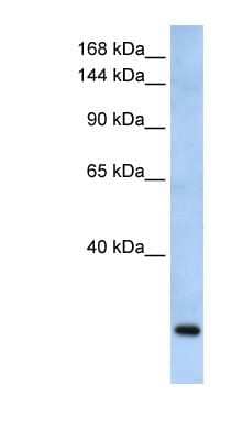 Western Blot: FBXW10 Antibody [NBP1-79496]