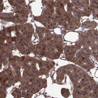 Immunohistochemistry-Paraffin: FBXW11 Antibody [NBP2-58829]