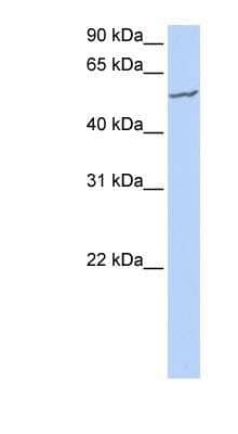 Western Blot: FBXW11 Antibody [NBP1-55069]