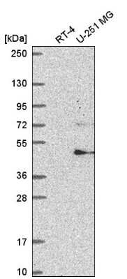 Western Blot: FBXW11 Antibody [NBP2-56451]