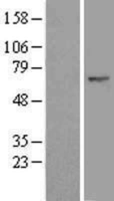 Western Blot: FBXW11 Overexpression Lysate [NBL1-10644]