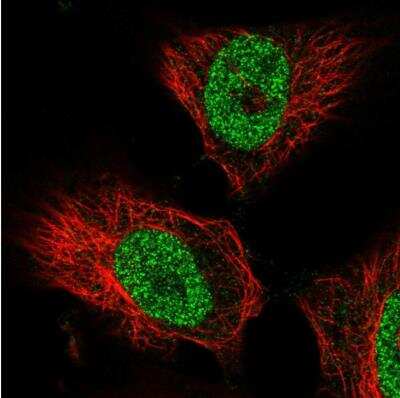 Immunocytochemistry/ Immunofluorescence: FBXW2 Antibody [NBP2-39089]