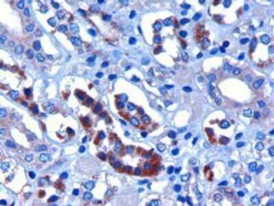 Immunohistochemistry: FBXW2 Antibody [NB100-1300]
