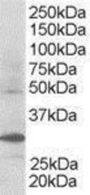 Western Blot: FBXW2 Antibody [NB100-1300]