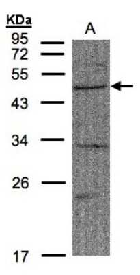 Western Blot: FBXW2 Antibody [NBP1-31019]