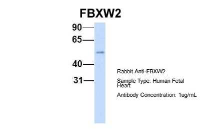 Western Blot: FBXW2 Antibody [NBP1-55043]