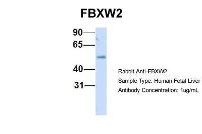 Western Blot: FBXW2 Antibody [NBP1-55043]