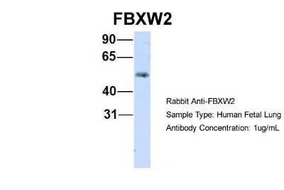 Western Blot: FBXW2 Antibody [NBP1-55043]