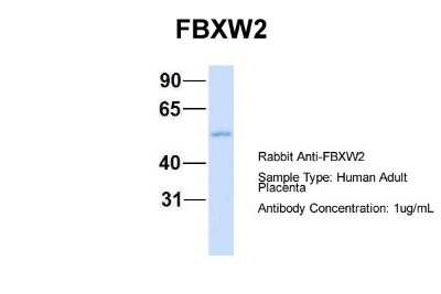 Western Blot: FBXW2 Antibody [NBP1-55043]