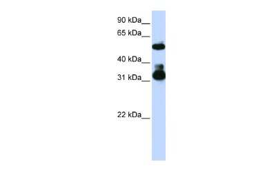 Western Blot: FBXW2 Antibody [NBP1-55043]