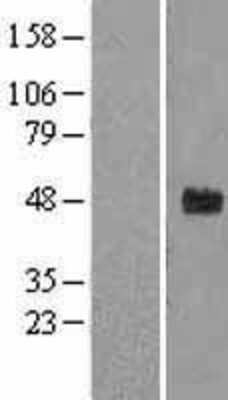 Western Blot: FBXW2 Overexpression Lysate [NBL1-10646]