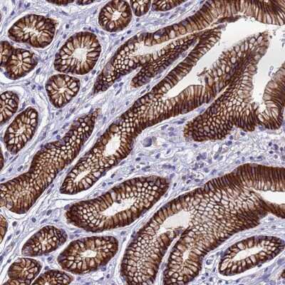 Immunohistochemistry-Paraffin: FBXW5 Antibody [NBP1-91892]