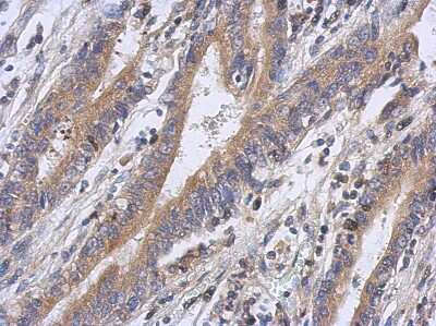 Immunohistochemistry-Paraffin: FBXW5 Antibody [NBP2-16455]