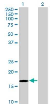 Western Blot: FBXW5 Antibody [H00054461-B01P]