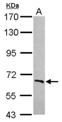 Western Blot: FBXW5 Antibody [NBP2-16455]