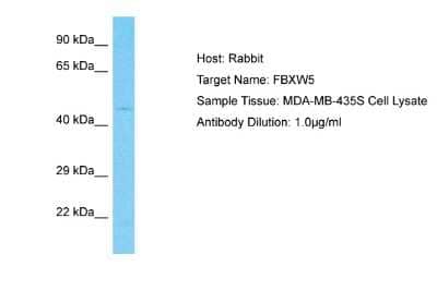 Western Blot: FBXW5 Antibody [NBP2-87437]