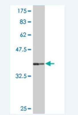 Western Blot: FBXW7/Cdc4 Antibody (1C11) [H00055294-M06]