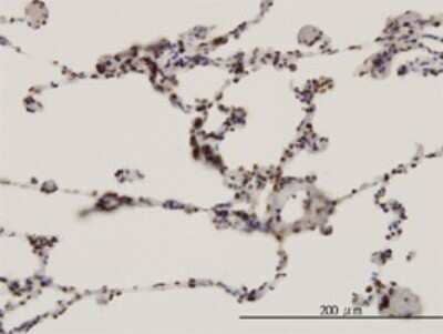 Immunohistochemistry-Paraffin: FBXW7/Cdc4 Antibody (3D1) [H00055294-M02]