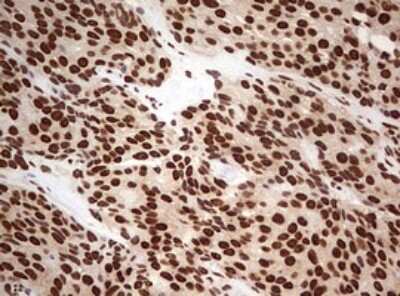 Immunohistochemistry: FBXW7/Cdc4 Antibody (OTI6F5) [NBP2-45623]