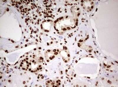 Immunohistochemistry: FBXW7/Cdc4 Antibody (OTI6F5) [NBP2-45623]