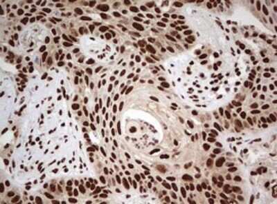 Immunohistochemistry: FBXW7/Cdc4 Antibody (OTI6F5) [NBP2-45623]