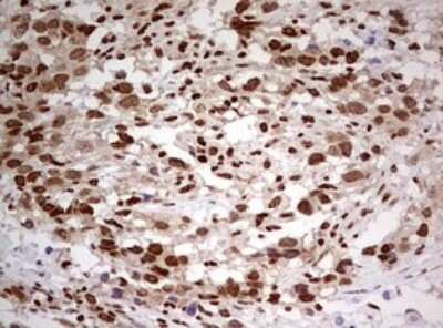 Immunohistochemistry: FBXW7/Cdc4 Antibody (OTI6F5) [NBP2-45623]