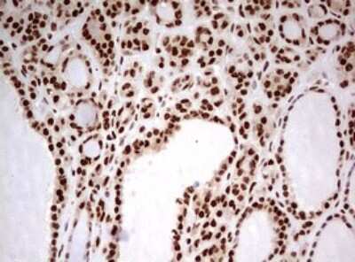 Immunohistochemistry: FBXW7/Cdc4 Antibody (OTI6F5) [NBP2-45623]