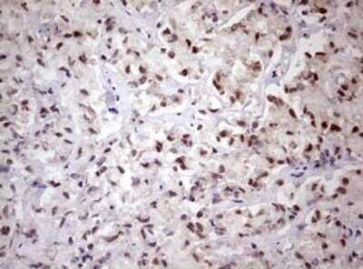 Immunohistochemistry: FBXW7/Cdc4 Antibody (OTI6F5) [NBP2-45623]
