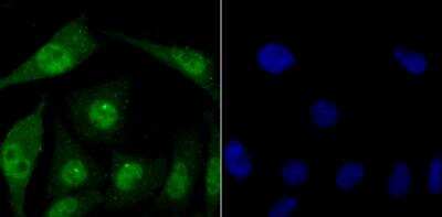Immunocytochemistry/ Immunofluorescence: FBXW7/Cdc4 Antibody [NBP2-89145]