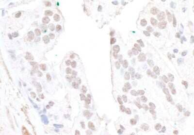 Immunohistochemistry: FBXW7/Cdc4 Antibody [NB100-88139]