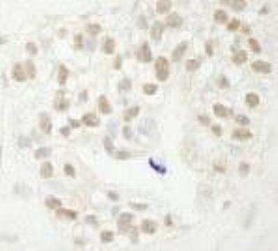 Immunohistochemistry-Paraffin: FBXW7/Cdc4 Antibody [NB100-88139]